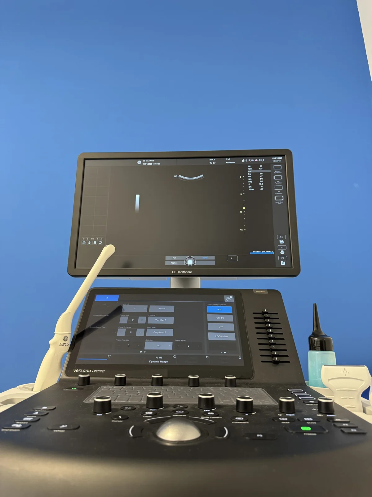 TRUS biopsija prostate